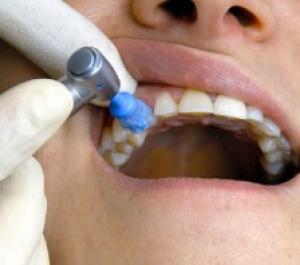 Oral hygiene exam